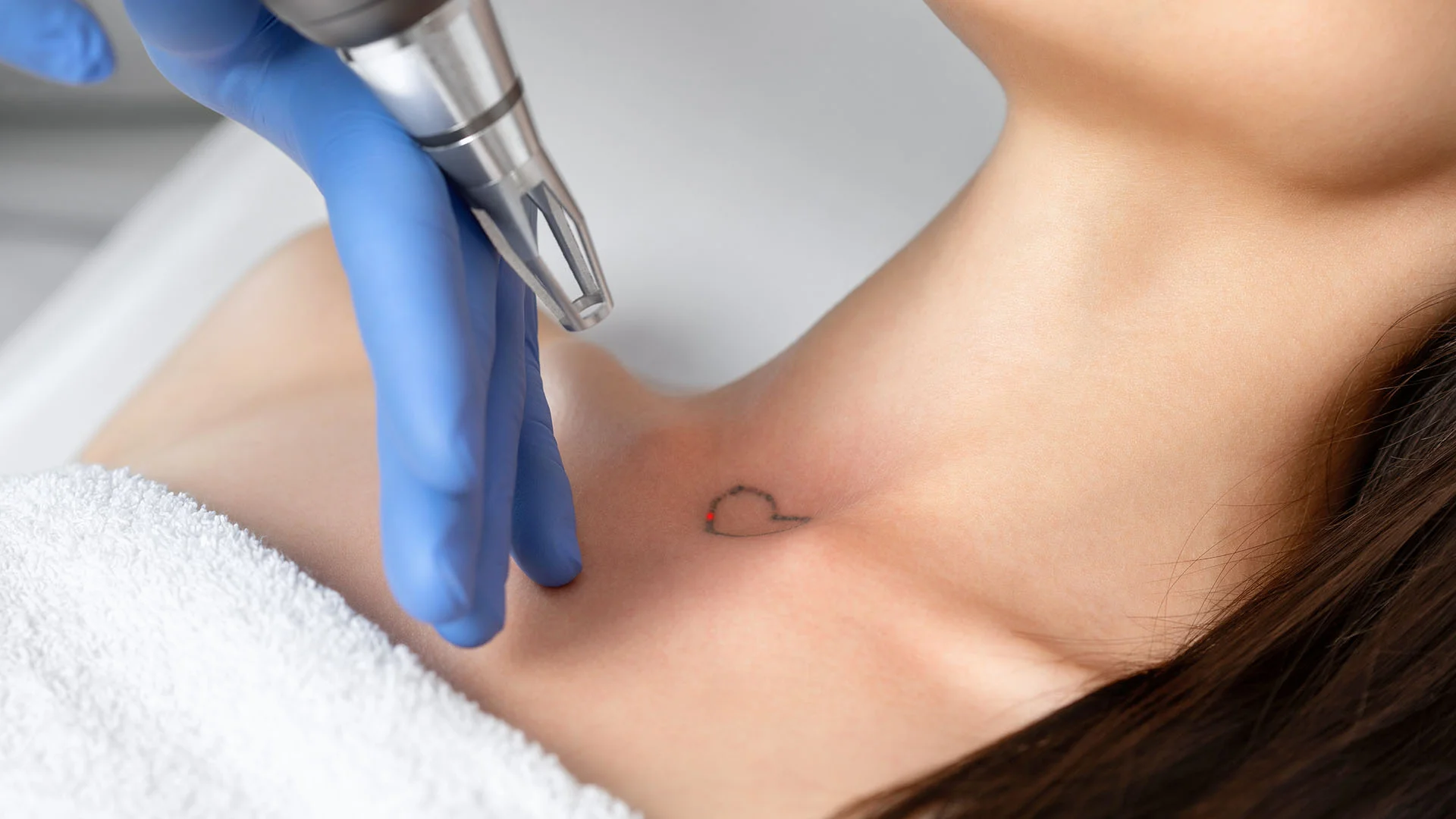 laser-tattoo-removal-banner