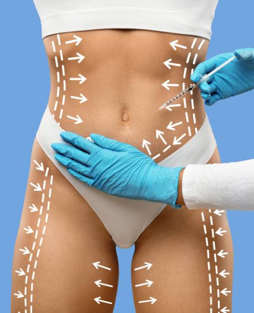 Tummy Tuck surgery in jubilee hills Hyderabad